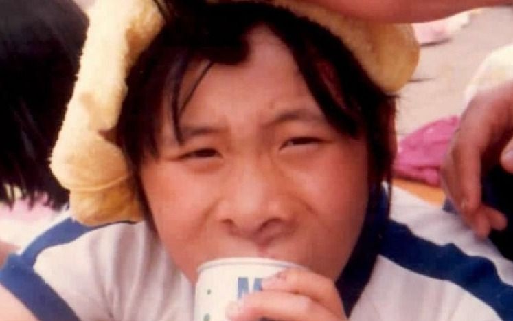 「お前に基本的人権はない」「見た目で採用できない」と告げられた就活…顔面動静脈奇形の女性(51)が語る、壮絶ないじめと面接官に言われた言葉 | 文春オンライン