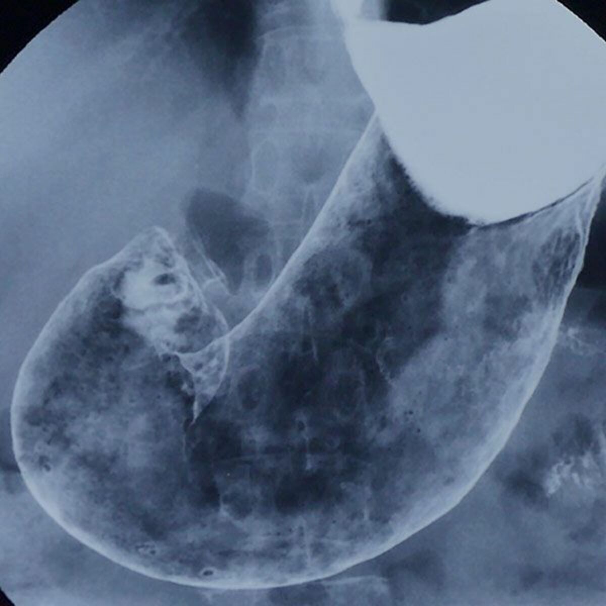 女子高生　肛門検査 