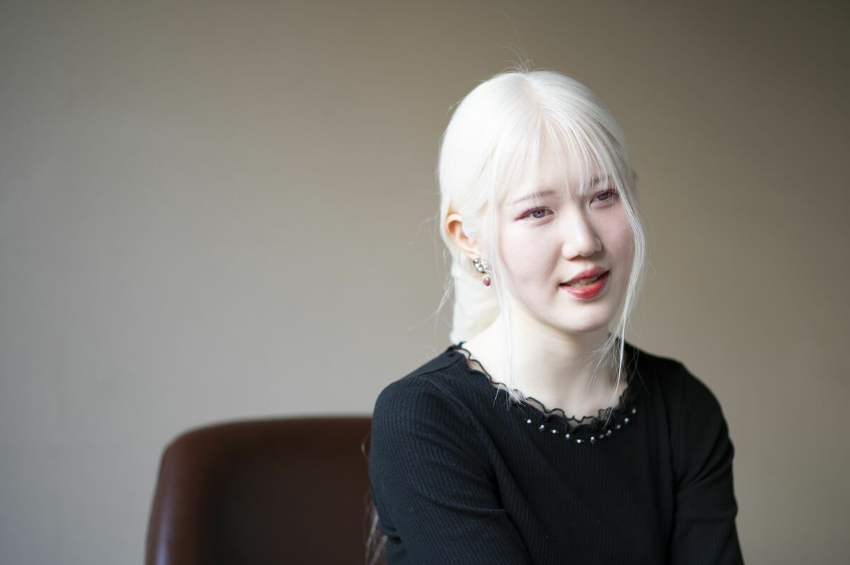 [写真](28ページ目)「ネットで『アルビノなのにブサイク』『かわいそう』と言われるけど…」“髪も肌も真っ白”なアルビノの女性（23）が ...