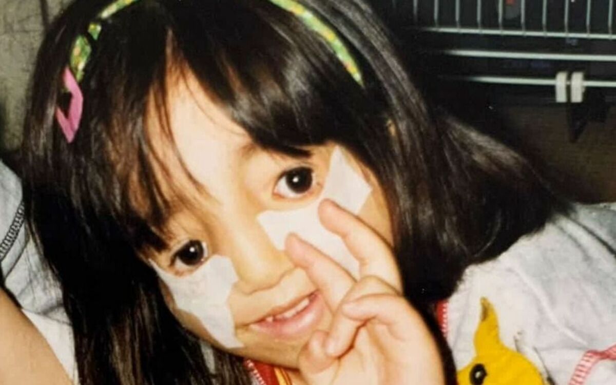 トリー チャー コリンズ 症候群