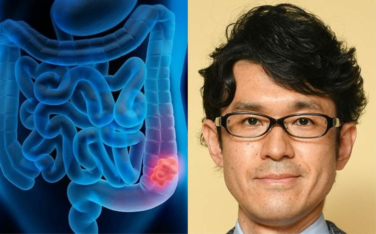 大腸がんの遺伝子検査はありますか?