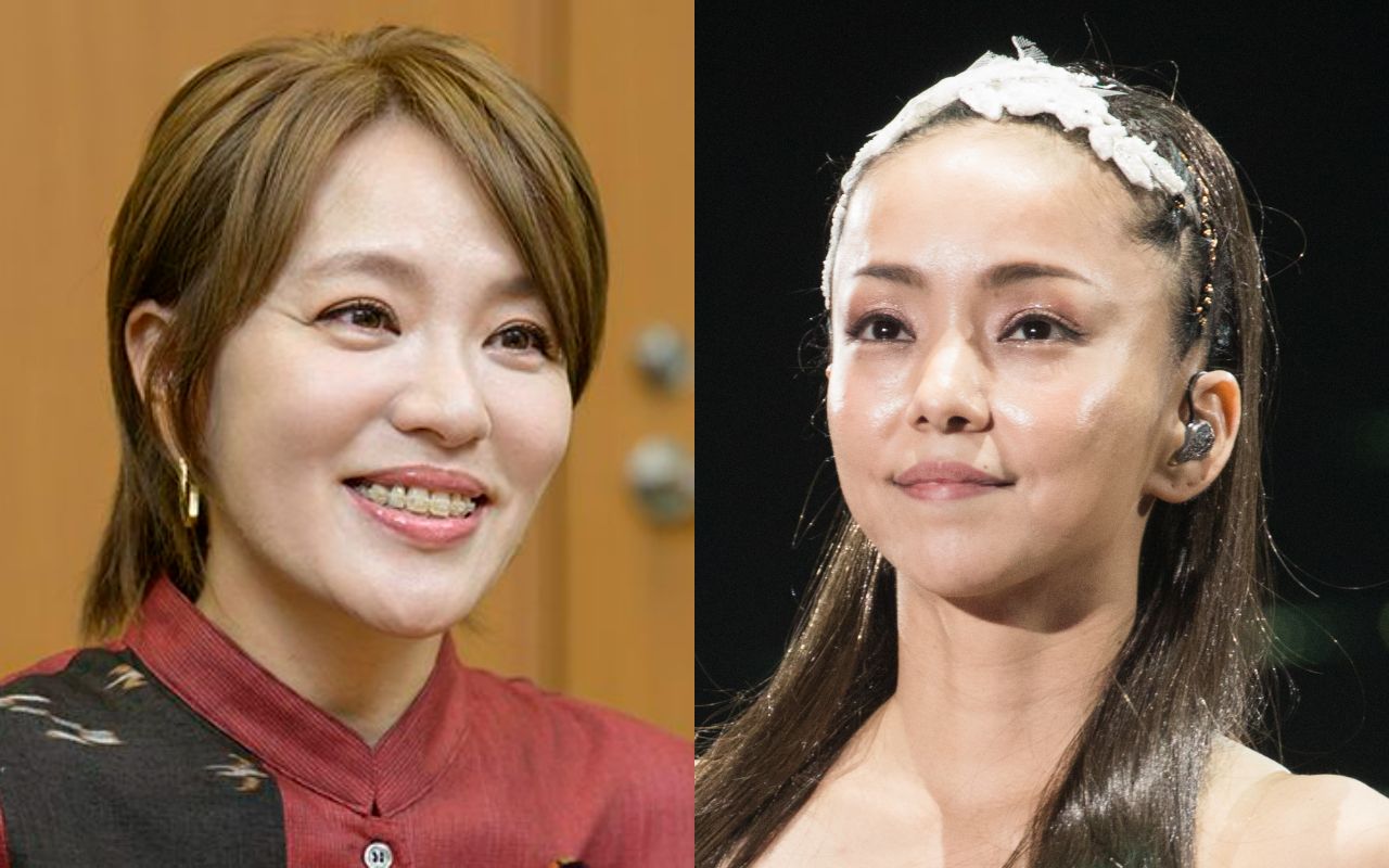 安室奈美恵整形