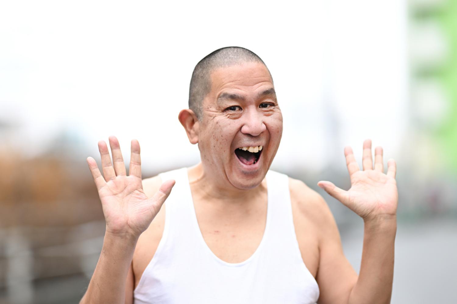 顔をめくる手術、命にかかわる体調不良から生還…63歳になった元「たま 