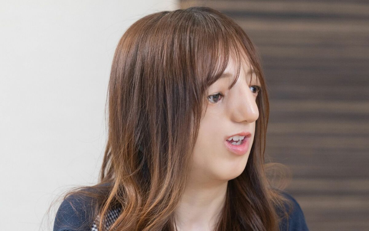 「こういう顔立ちだからテレビには出られない存在だって…」トリーチャー・コリンズ症候群の女性(32)が語る、メディアへの本音 | 文春オンライン