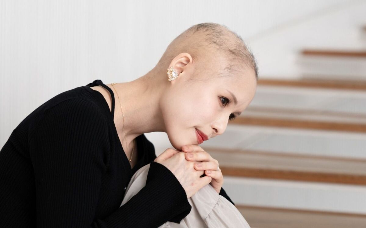 「みんな髪が黒いのに、私だけ薄い」生まれつき髪が少なく、クラスで“ハゲ”とイジメられ…1万人に1人の病気の女性が明かす、子ども時代のコンプレックス | 文春オンライン