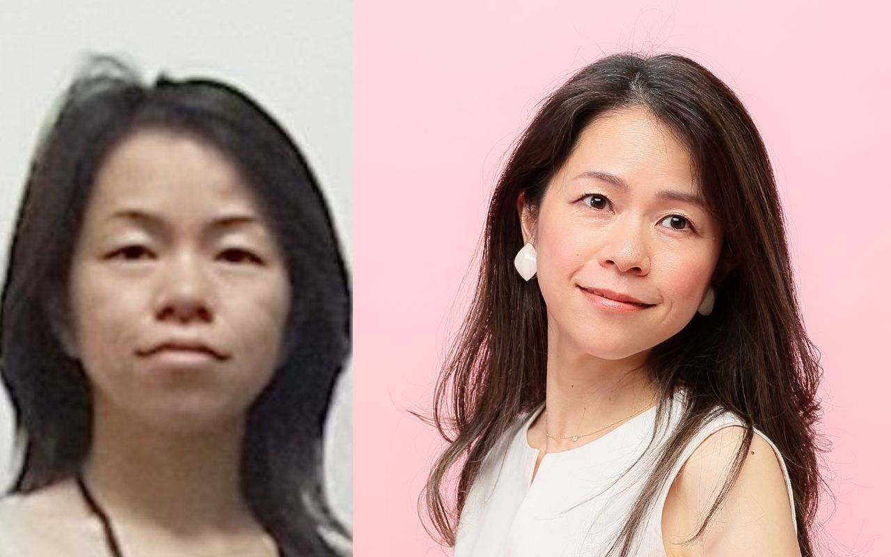 北川 景子 整形