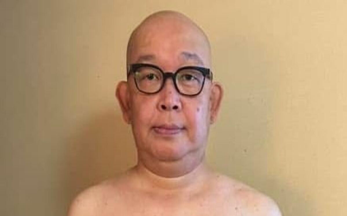 糖尿病 足 切断 有名人