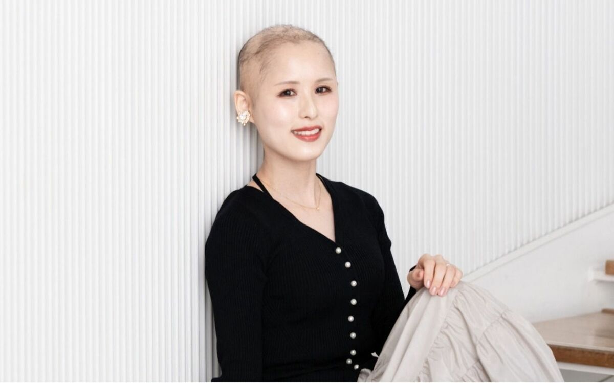「寝ているときもウィッグをつけていた」結婚後も“夫に頭を隠し続けた”結果…“生まれつき髪が少ない病気”の女性が明かす、夫にありのまま姿を見せた瞬間 | 文春オンライン