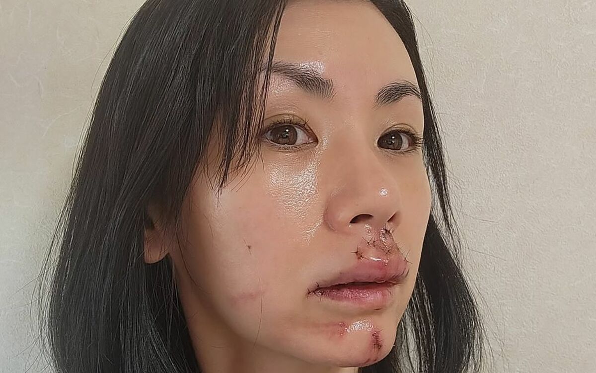 小島 可奈子