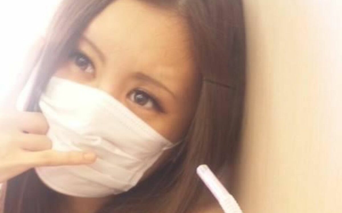 「私が生まれた瞬間、分娩室がシーンと…」鼻、唇、耳がなく生まれた女性(31)が明かす、生後3カ月で受けた壮絶だった手術 | 家族と病 | 文春オンライン