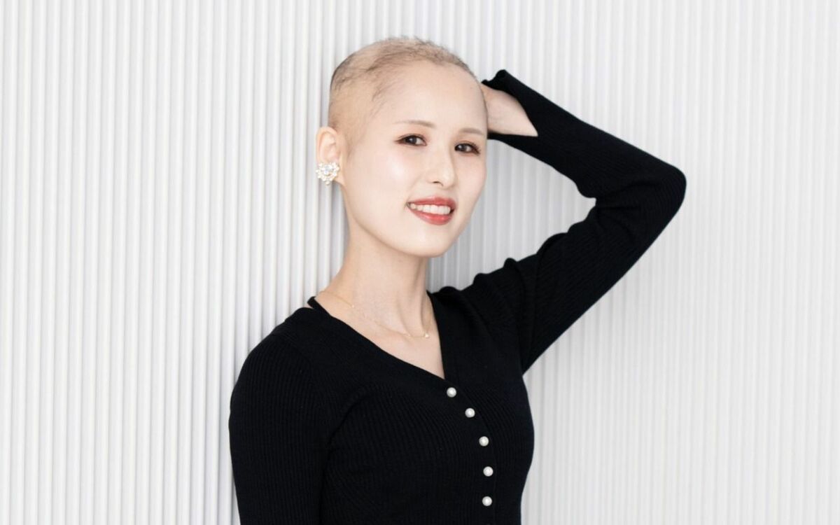 「もう生きたくない」高校でクラス全員からイジメ→担任は見て見ぬふり…“生まれつき髪が少ない病気”の女性が語る、ツラい学校生活が変わった“きっかけ” | 文春オンライン