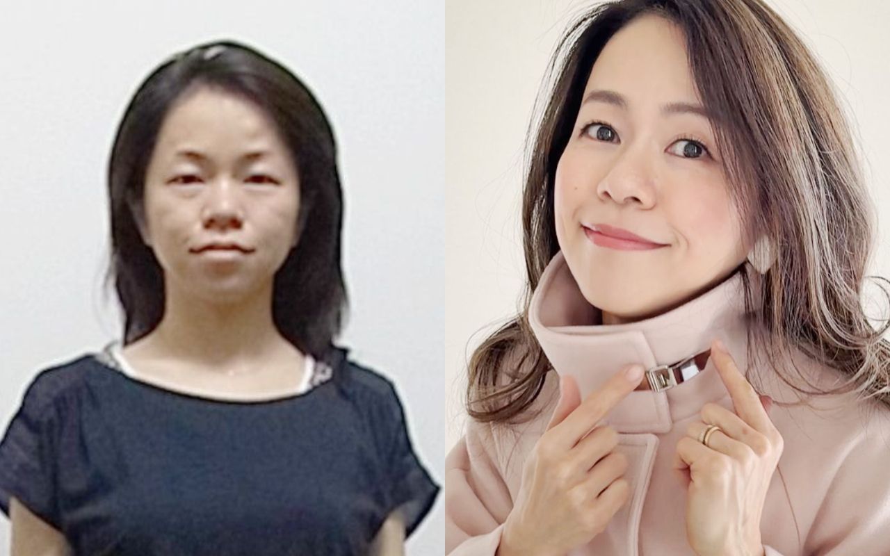 当時のメディア報道・掲載写真