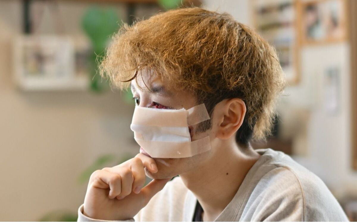 顔 黒く なる 病気