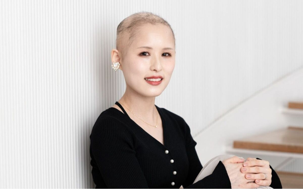 「私の髪は何なの?」同級生から「ハゲ」とイジメられ、親戚から“最悪な言葉”も…“生まれつき髪が少ない病気”の女性が明かす、子ども時代の苦悩 | 文春オンライン
