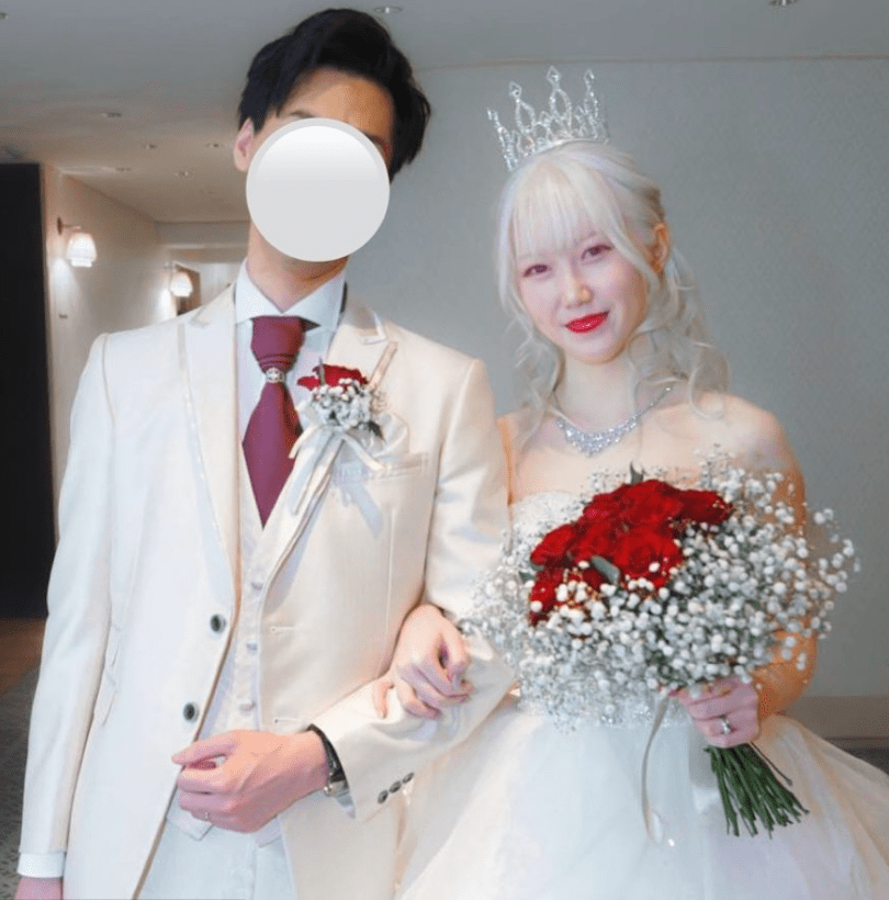 [写真](10ページ目)「ネットで『アルビノなのにブサイク』『かわいそう』と言われるけど…」“髪も肌も真っ白”なアルビノの女性（23）が ...