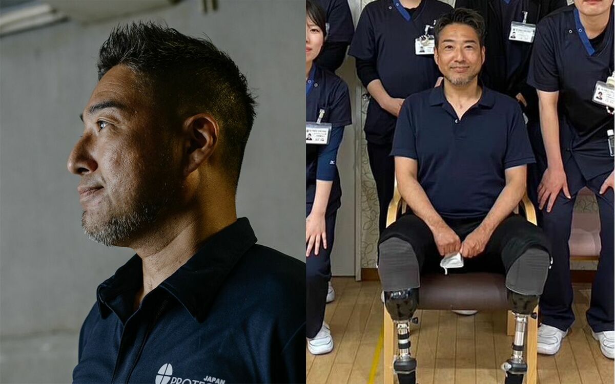 「あえて“むき出し”にしています」両手両脚を切断→体重35キロ減で“骨と皮だけのようだった”時期も…49歳の義足ランナーが語る“見られること”への素直な本音 | 家族と病 | 文春オンライン