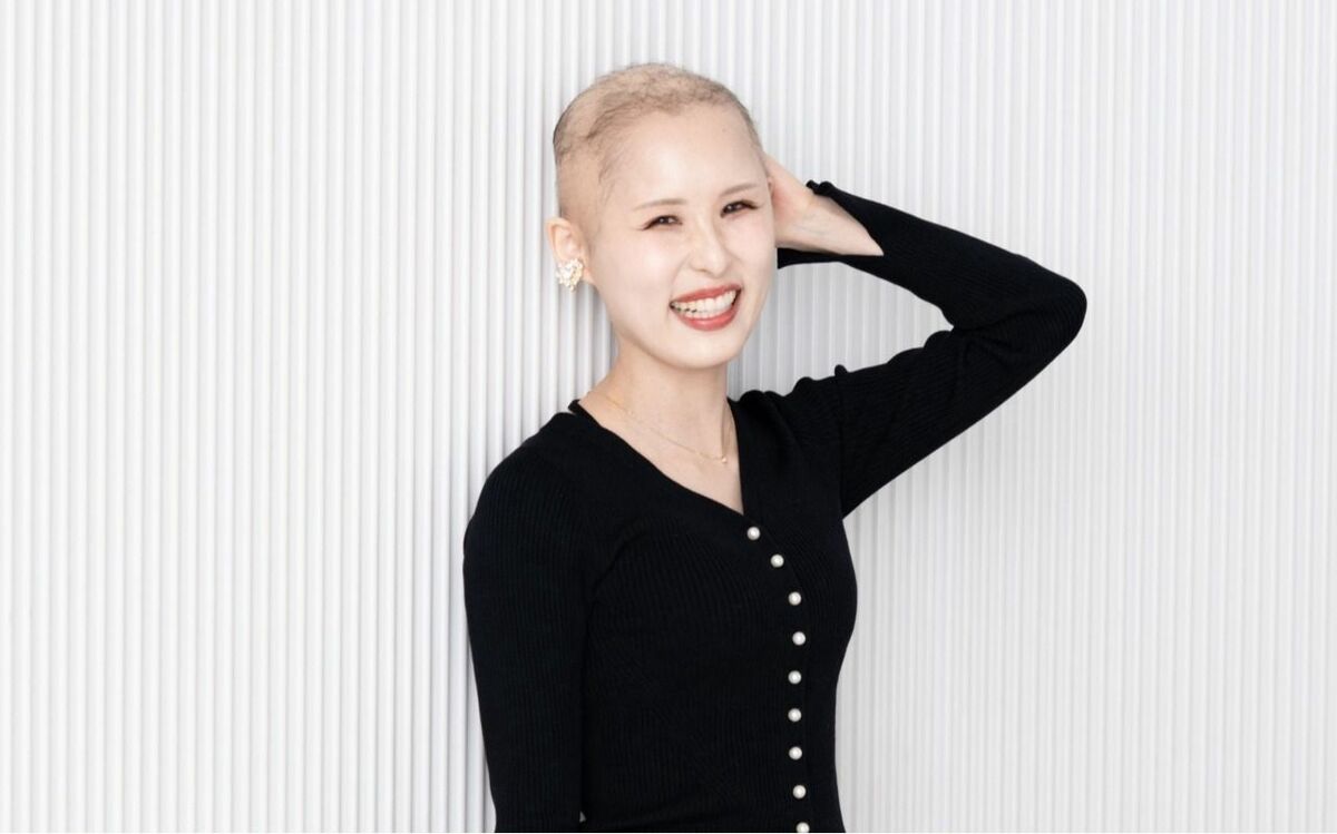 「制服姿に薄い髪で、すごく目立っていた」知らない人から笑われたことも…“生まれつき髪が少ない病気”の女性が明かす、ウィッグをかぶって一変した周囲の反応 | 文春オンライン