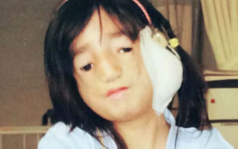 担当医から「こういう子は早く死にますよ」と…頬骨が未発達のまま生まれた女性(32)にYouTubeでは「強く感銘を受けた」「とても聡明な方だ」との声 | 文春オンライン